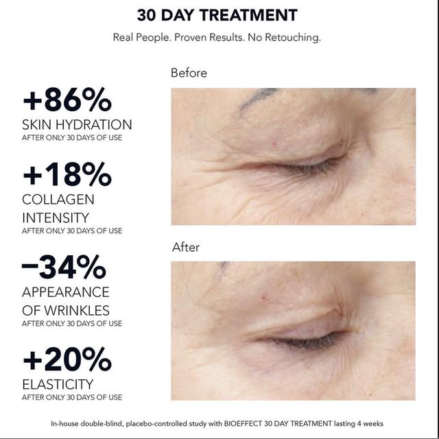 Bioeffect เซรั่มทรีทเม้นท์ ฟื้นฟูผิวเร่งด่วน มี 2 ขวด