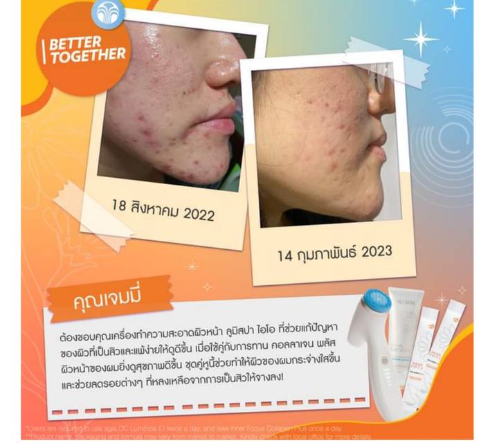 เครื่องล้างหน้าลูมิสปา