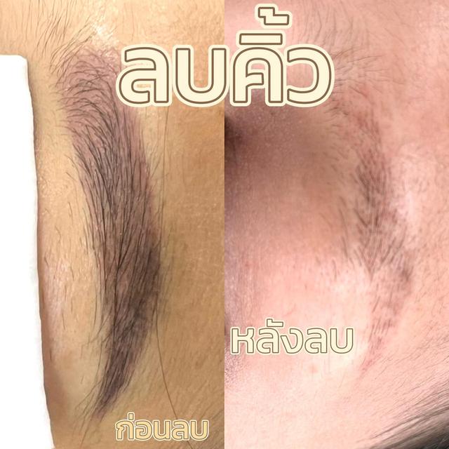 Wonpink Beauty Huahin (ร้านสักคิ้วหัวหินใบหม่อน) ร้านสักคิ้วหัวหิน สักคิ้วโหงวเฮ้ง ฝังสีปาก สักอายไลเนอร์ ลิฟต์ขนตา จี้ไฝ แว๊กซ์คิ้ว ครบจบในที่เดียว รูปที่ 10