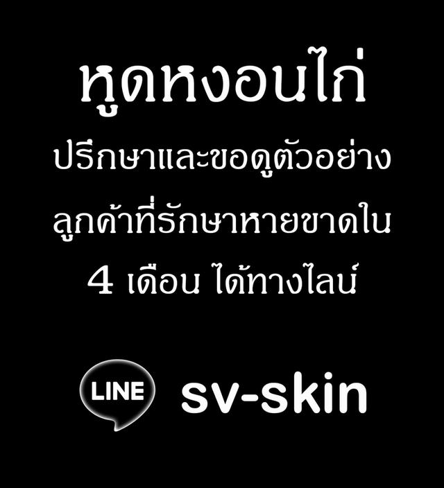 หูดหงอนไก่ที่อวัยวะเพศ หูดหงอนไก่ที่ทวารหนัก หูดหงอนไก่ที่ผิวหนัง รักษาหายขาดใน 4 เดือน ปรึกษาฟรี LINE: sv-skin