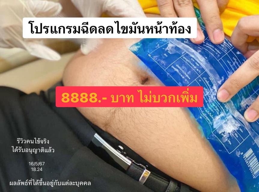 แฟตสลายลดไขมันหน้าท้อง