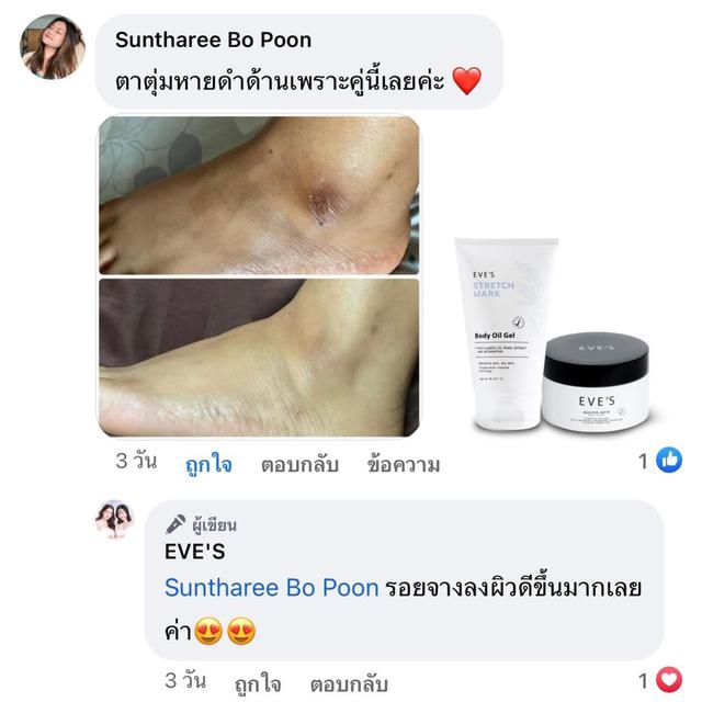 ครีมทาแก้แตกลาย