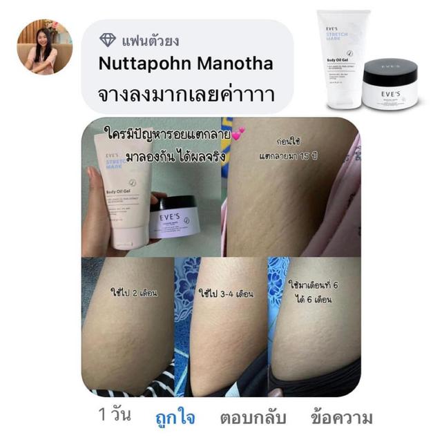 ครีมทาแก้แตกลาย 6