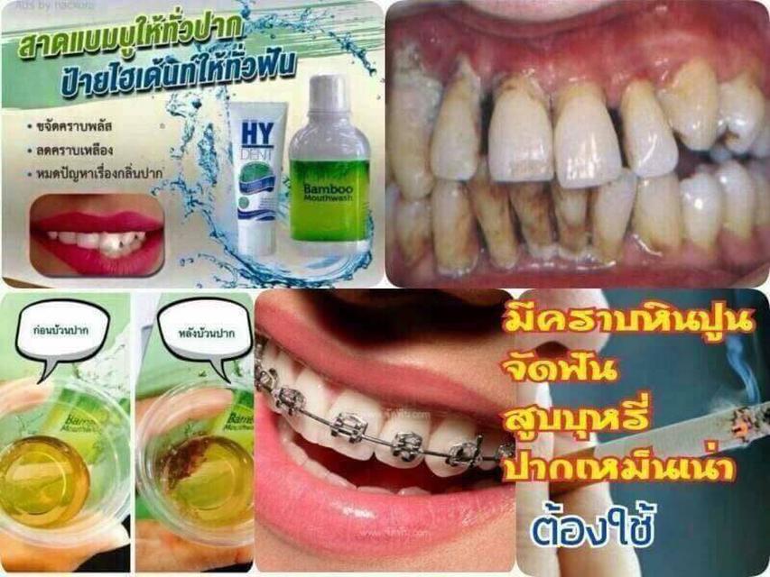 น้ำยาบ้วนปากแบมบู เม้าท์วอช (Hylife Bamboo mouthwash) 3