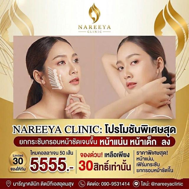 ร้อยไหมคอลลาเจน หน้าแน่น หน้าเฟิม