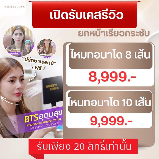 เปิดรับเคสรีวิว