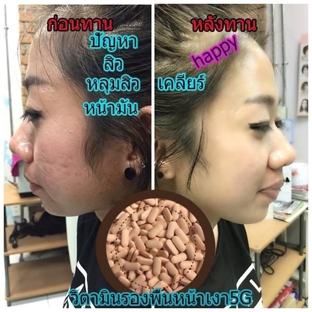 ผิวขาว ลดน้ำหนัก ดีท็อก หน้าเรียว 10