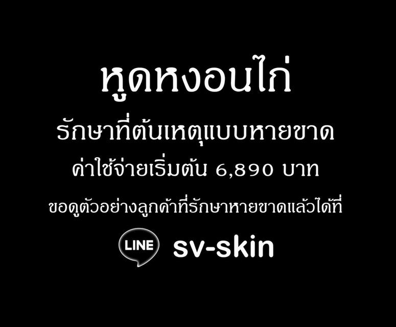 หูดหงอนไก่ในปาก หูดหงอนไก่ที่ลิ้น หูดหงอนไก่ในลำคอ รักษาที่ต้นเหตุแบบหายขาด |  LINE: sv-skin
