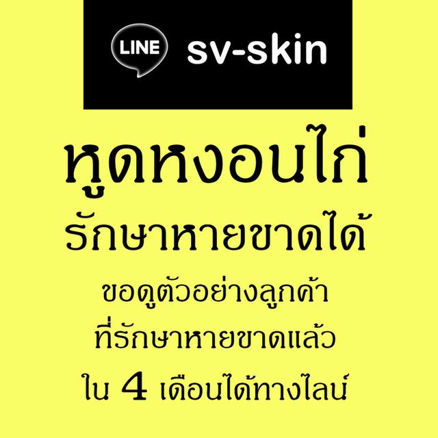 #หูดหงอนไก่ในปาก #หูดหงอนไก่ที่ลิ้น #หูดหงอนไก่ในลำคอ รักษาหายขาด ปรีกษาฟรี