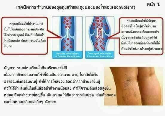 ชุดชั้นในซัมมิทควีนปรับสรีระกระชับรูปร่าง 18