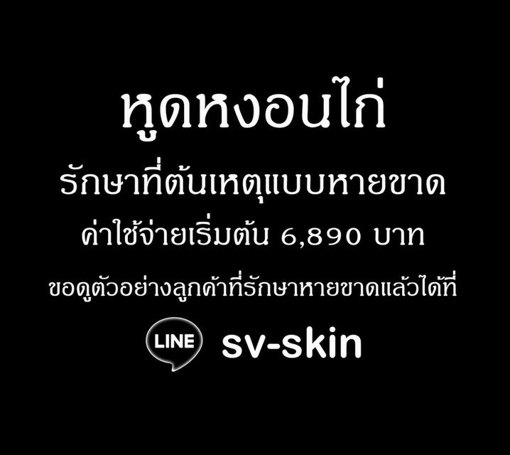 หูดหงอนไก่ ต้นเหตุมะเร็งช่องคลอด มะเร็งอวัยวะเพศ มะเร็งทวารหนัก LINE: sv-skin
