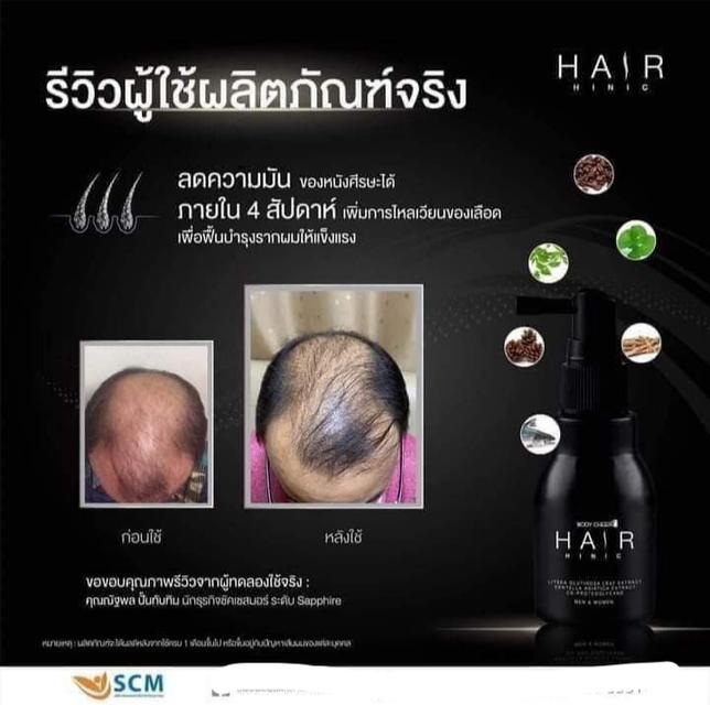 เซรั่มบำรุงผมแฮร์ไฮนิค ช่วยลดปัญหาผมร่วงผมบางผมหงอกก่อนวัยคันหนังศีรษะช่วยลดความมันบนหนังศีรษะราคา 1,190 บาทปริมาณ 75 ml 5