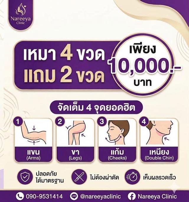 แฟตสลายไขมันแก้ม เหนียง