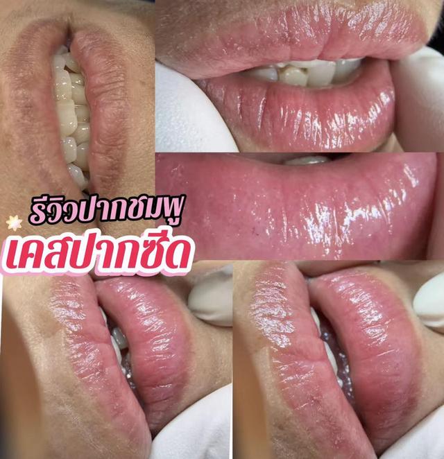Wonpink Beauty Huahin (ร้านสักคิ้วหัวหินใบหม่อน) ร้านสักคิ้วหัวหิน สักคิ้วโหงวเฮ้ง ฝังสีปาก สักอายไลเนอร์ ลิฟต์ขนตา จี้ไฝ แว๊กซ์คิ้ว ครบจบในที่เดียว รูปที่ 9