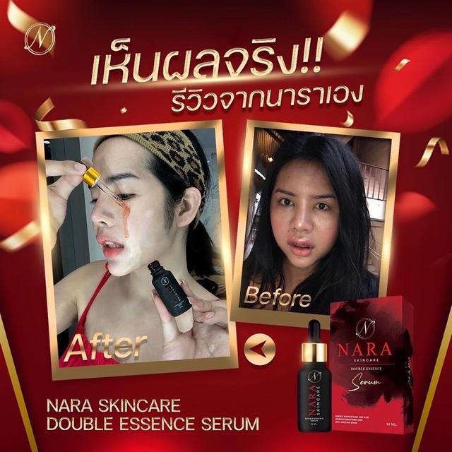 NARA WHITENING BOOSTER SERUM เซรั่มนารา ผิวใส 15ML