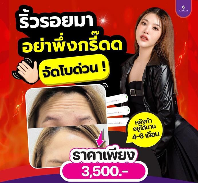 ริ้วรอยเยอะไม่ต้องกังวลอีกต่อไป