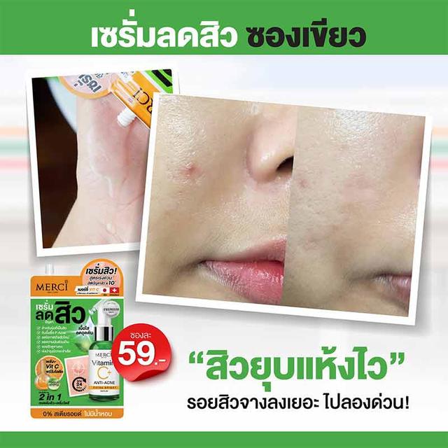 Merci Vitamin C+ Anti-Acne Extra Bright Serum เซรั่ม ลดสิว 4g. (ยกกล่อง x 6ซอง) 3