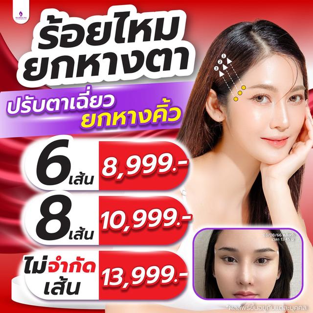 ร้อยไหมยกคิ้ว ยกหางตา