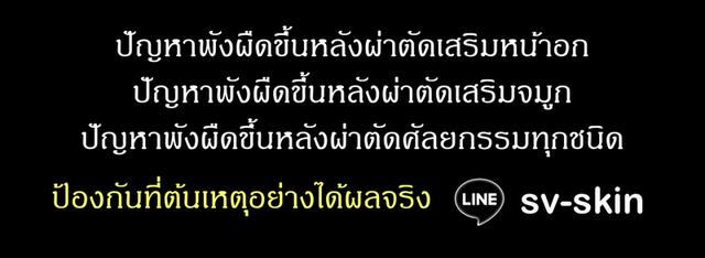 เครียดเรื้อรัง โกรธโมโหง่าย ขี้โกรธขี้โมโห ขี้หงุดหงิด อารมณ์เสียง่าย ช่วยให้อารมณ์ดีสงบอย่างได้ผลจริง LINE: sv-skin