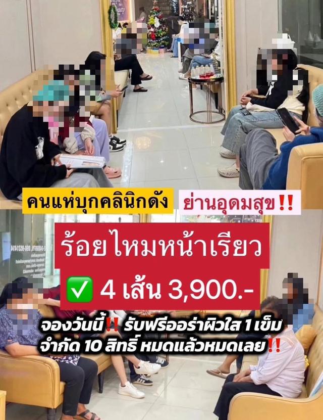 ร้อยไหมหน้าเรียว