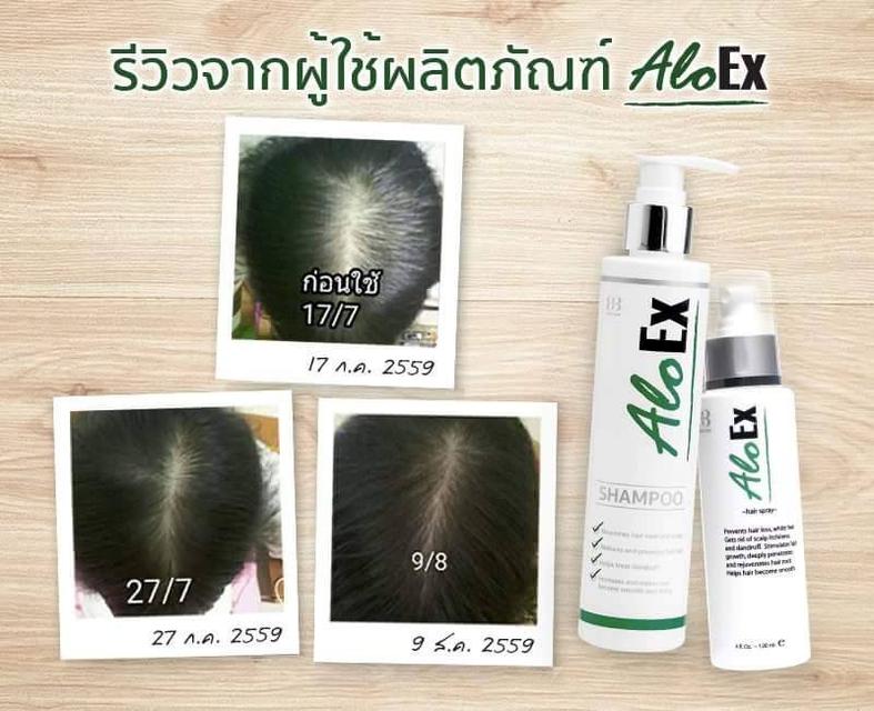 AloEx Hair Regrowth Serum เซรั่มสำหรับคนผมบางและผมร่วง อโลเอ็กซ์ (ส่งฟรี EMS)