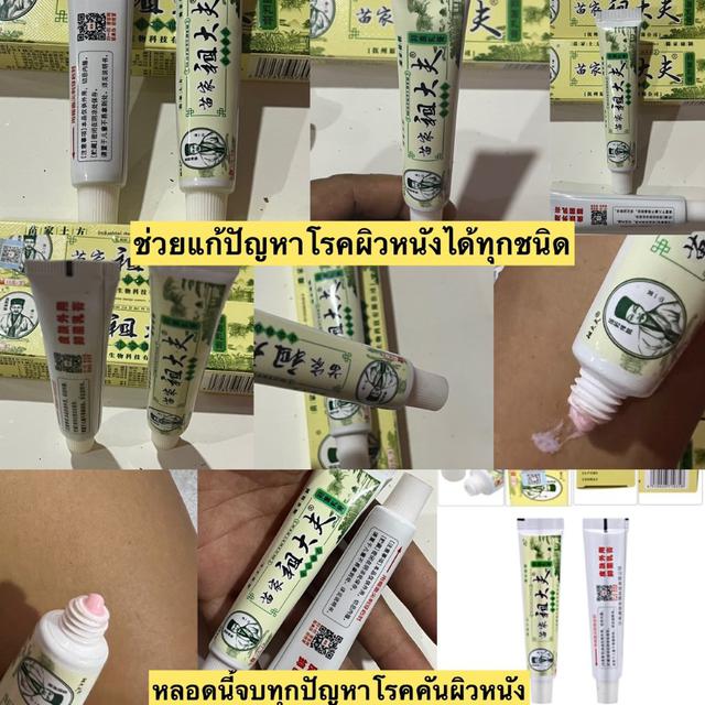 ยาทาแก้คันจีน 4 หลอด 300 บาท 4