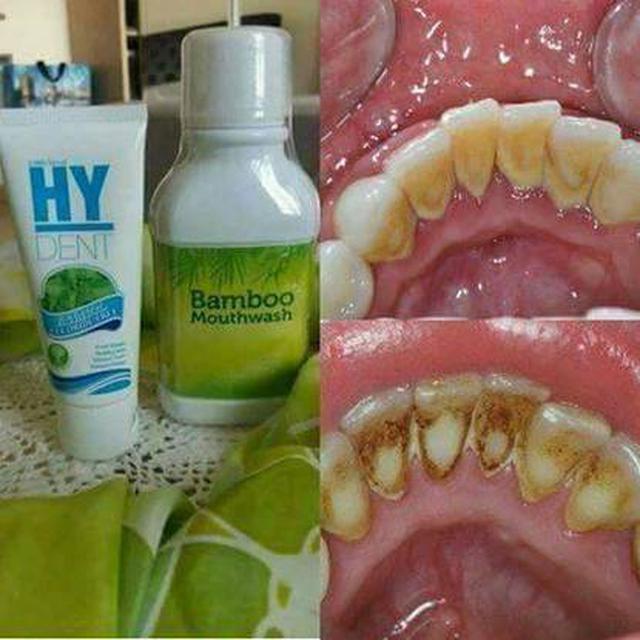 น้ำยาบ้วนปากแบมบู เม้าท์วอช (Hylife Bamboo mouthwash) 5