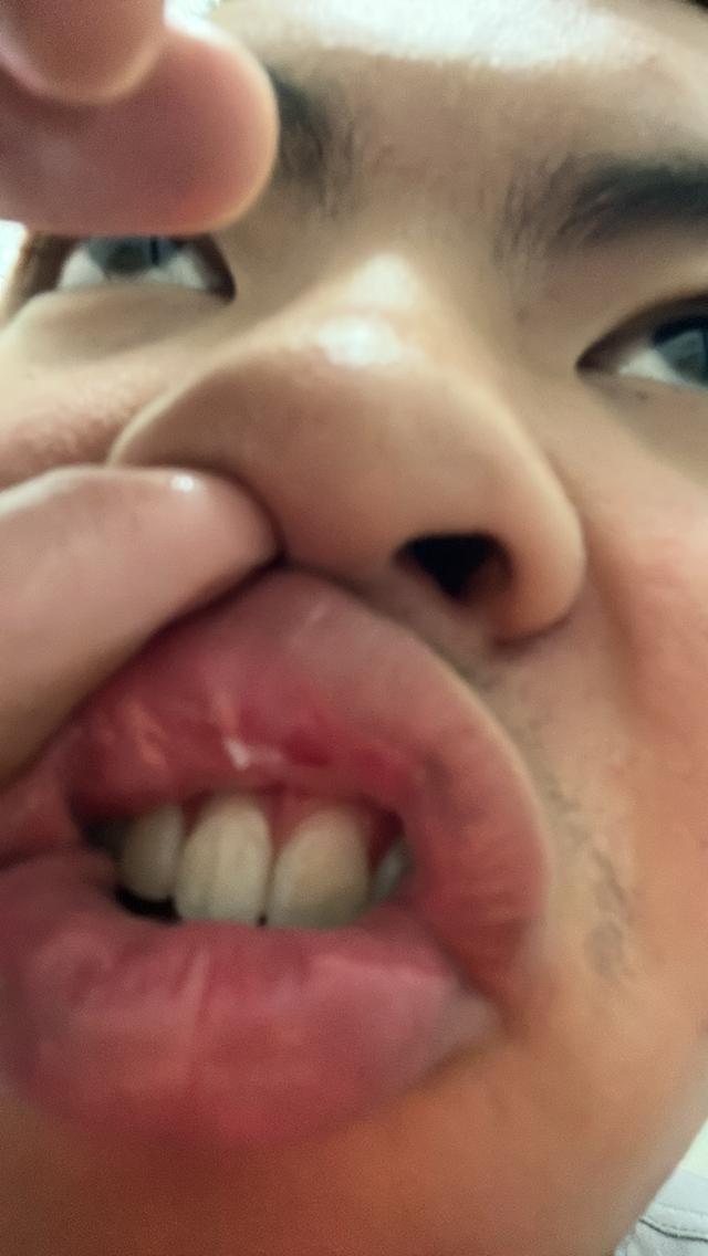 สุนัข ดัชชุน