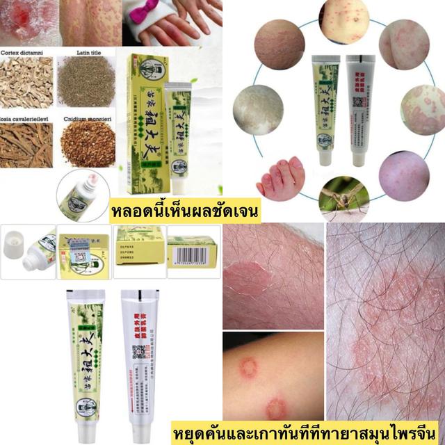 ยาทาแก้คันจีน 4 หลอด 300 บาท 6