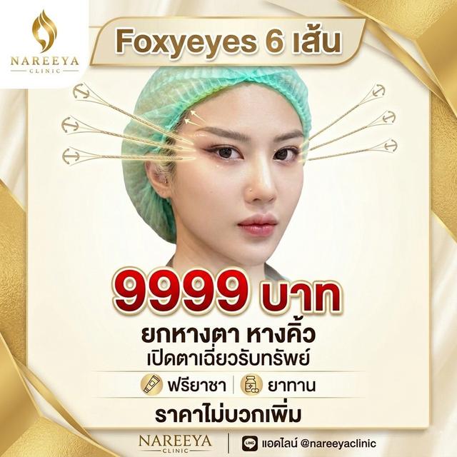 ยกหางคิ้ว ยกหางตา 6 เส้น 9,999.-