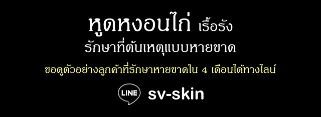 หูดหงอนไก่ รักษาหายขาดใน 4 เดือน ปรึกษาฟรี LINE: sv-skin