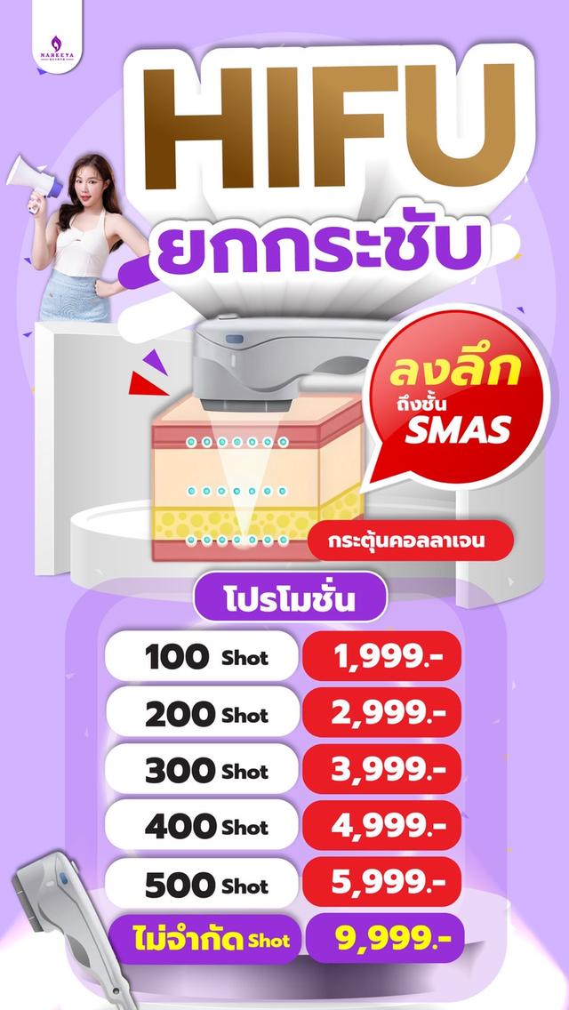ยกกระชับด้วยเครื่องไฮฟู่