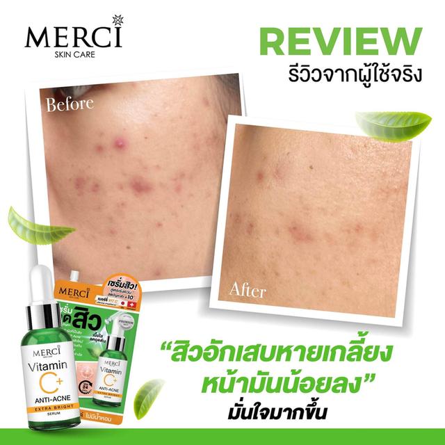 Merci Vitamin C+ Anti-Acne Extra Bright Serum เซรั่ม ลดสิว 4g. (ยกกล่อง x 6ซอง)