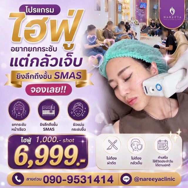 ไฮฟูยกกระชับหน้าเฟิม