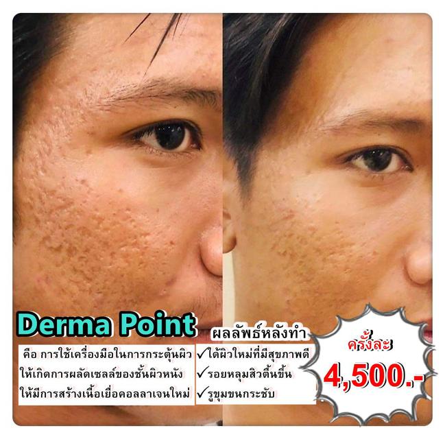 รูป เดอม่าพ้อย