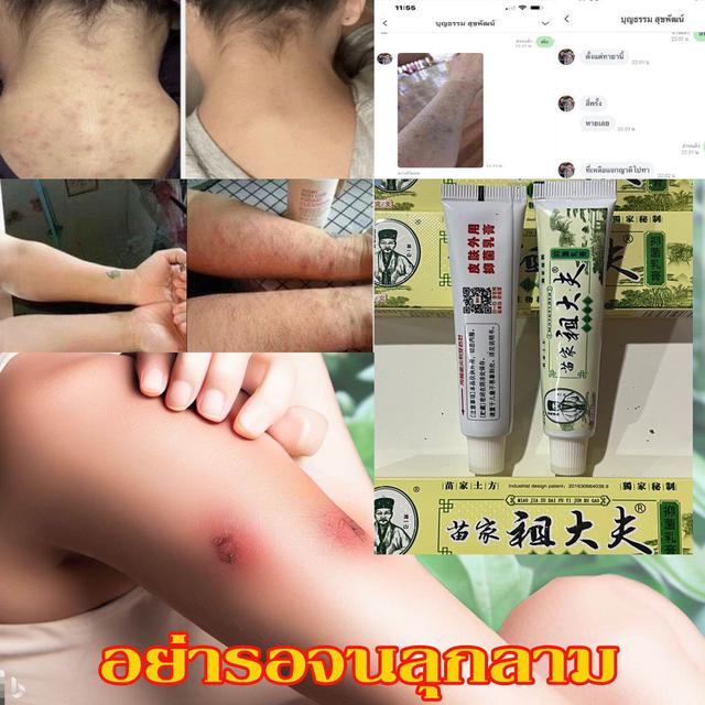 รูป ยาทาแก้คันจีน 2 หลอด 220 บาท