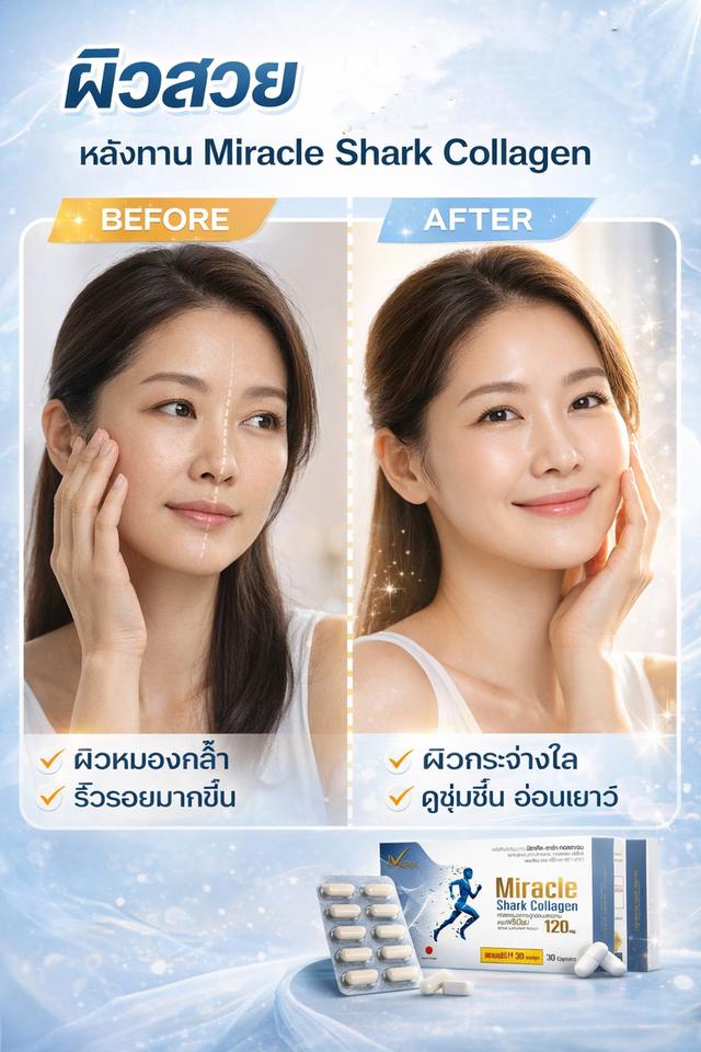 คอลลาเจน ดูแลข้อเข่า กระดูกอ่อนปลาฉลาม🇯🇵SharkCartilage รูปที่ 13