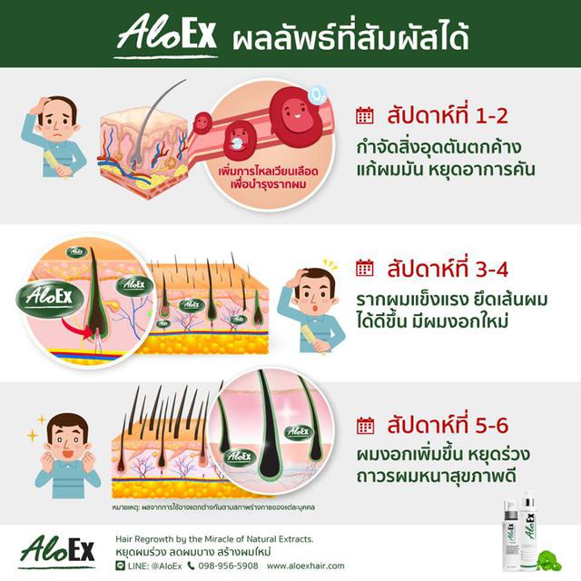 AloEx Hair Regrowth Serum เซรั่มสำหรับคนผมบางและผมร่วง อโลเอ็กซ์ (ส่งฟรี EMS) 6