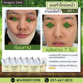 เปิดรีวิวหลังทำศัลยกรรม