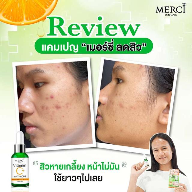 MERCI เซรั่มสูตรลดปัญหาสิว Merci VITAMIN C+ ANTI-ACNE EXTRA BRIGHT SERUM 15 ml.