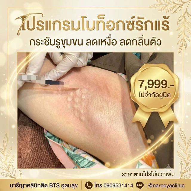 โบรักแร้ ไม่จำกัดยูนิต
