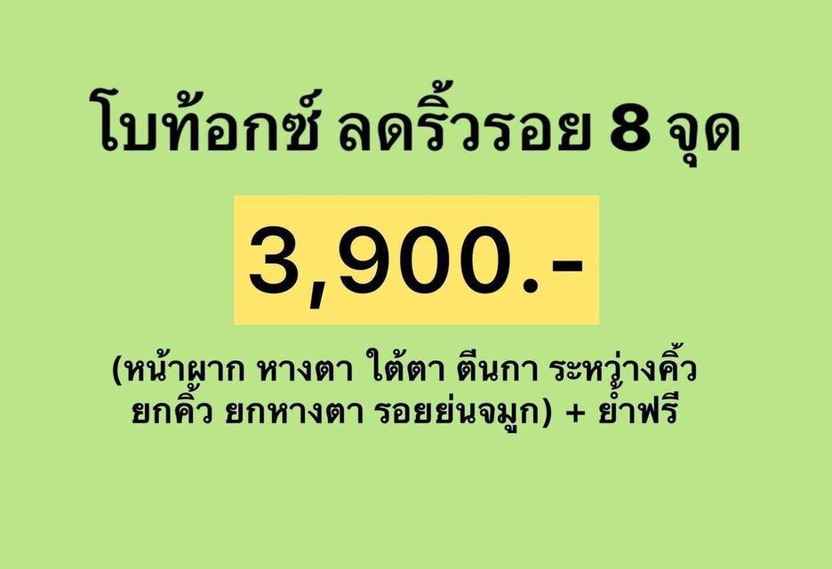 ริ้วรอย 8 จุด