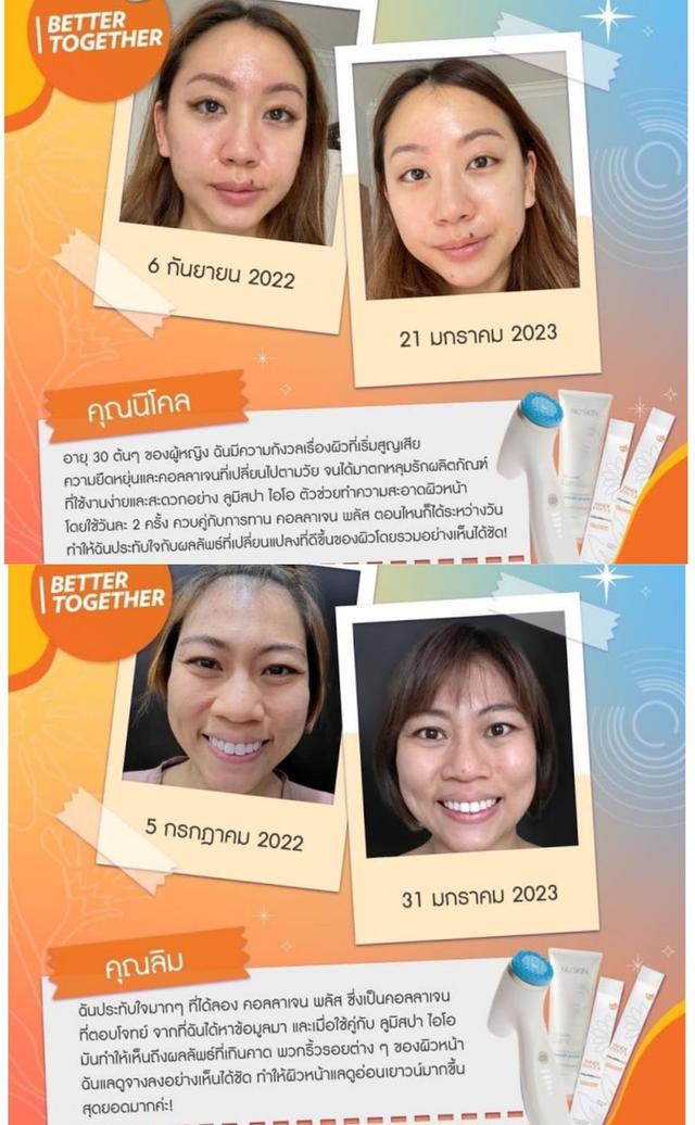 เครื่องล้างหน้าลูมิสปา