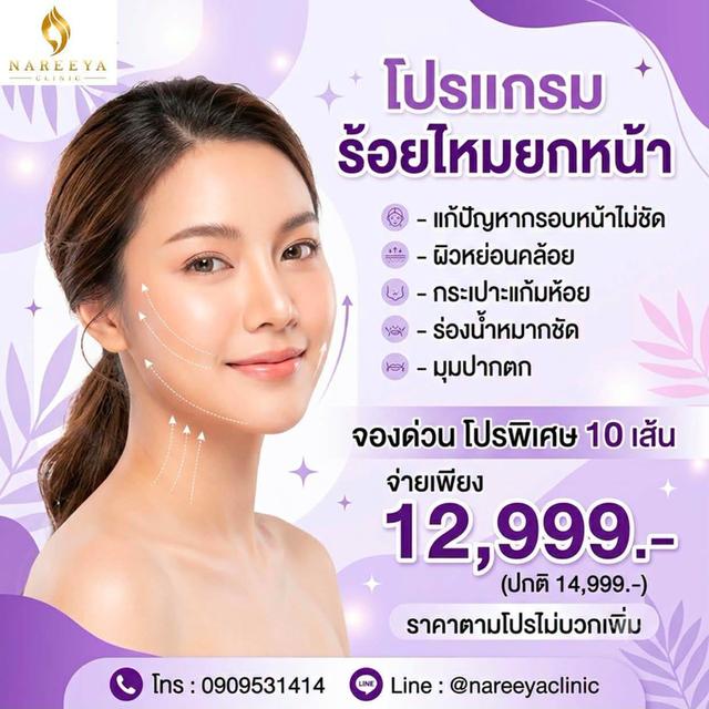 ร้อยยกกระชับหน้าวีเชฟคูณสอง