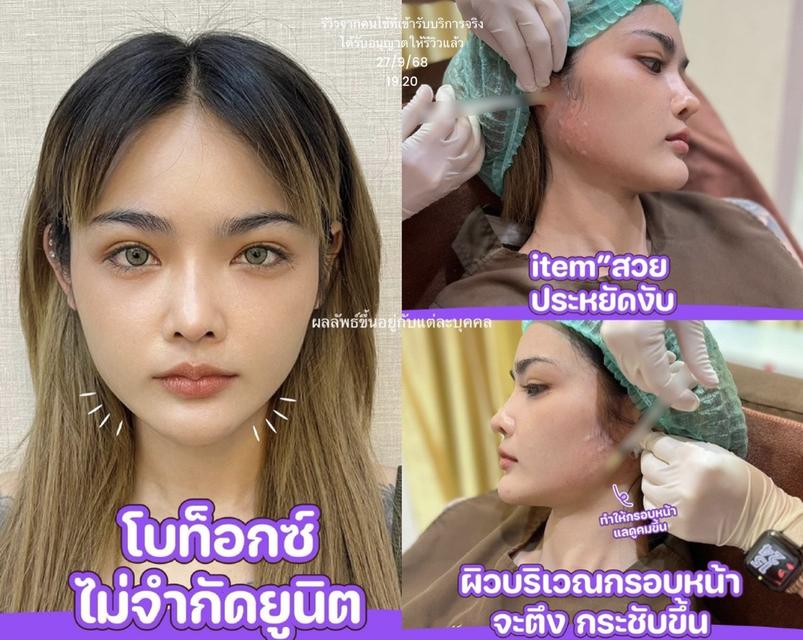 โบท็ออก3รายการเพียง4999จองด่วนเลยค่ะ มีย้ำฟรี ไม่จำกัดยูนิต รูปที่ 3