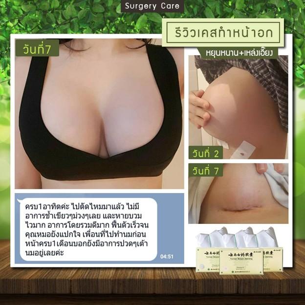 เหล่งเอี๊ยง EXTRA เร่งฟื้นตัว ผ่าตัดศัลยกรรมหายไว รูปย่อยที่ 4