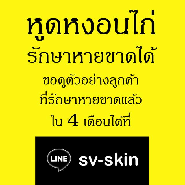 #หูดหงอนไก่ รักษาที่ต้นเหตุแบบหายขาด ปรีกษาฟรี LINE: sv-skin