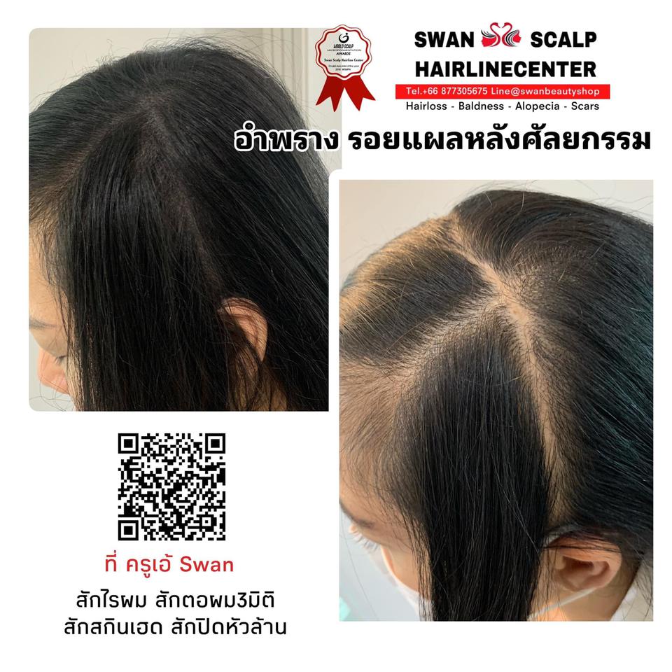 อันดับหนึ่ง 103+ ภาพพื้นหลัง สักตอผม คมชัด