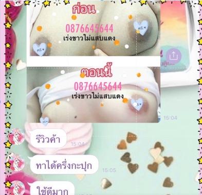 ครีมทำให้หัวนมชมพู    ครีมแก้ปากดำ
